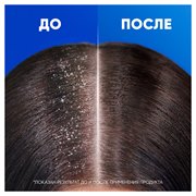 Head&Shoulders Шампунь от перхоти и бальзам для волос Ментол 2в1 360мл 8700216351546 - фото 51643